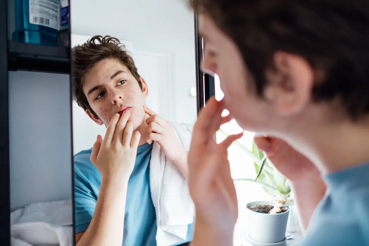 Dealing with acne? Here’s how to shave safely.