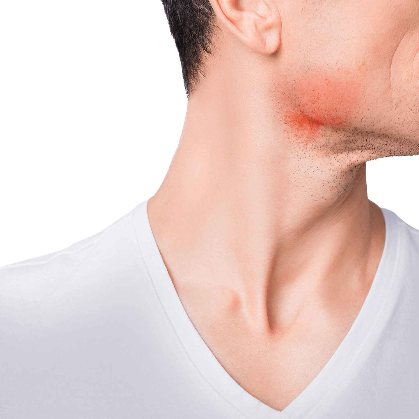 What causes shaving rash and how you can prevent it